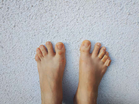Woman's legs with a plasters to a callus on toes. Foot skin care and prevention of corns, calluses....