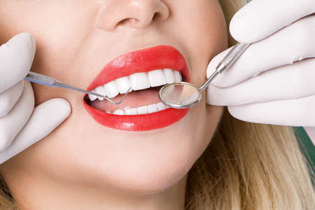Porcelain veneers. Pretty female model with perfect smile. Young beautiful woman with beautiful white teeth. Teeth whitening.の写真素材