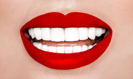 Porcelain veneers. Laughing woman with perfect teeth over white background. Whitening concept. Dentistry. Smile with white teeth.の写真素材