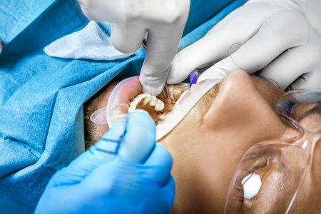 Close-up shot of attentive doctors performing surgical operation installing dental implants into...