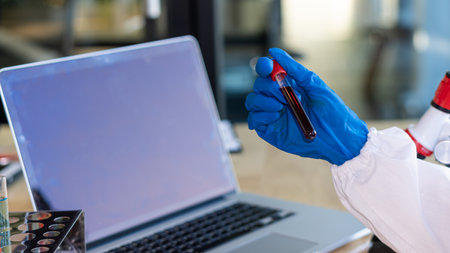 A test tube with blood in the hand of a doctor For concept analysis - virologist tests blood A man in a doctor's uniform With a laptop placed in frontの写真素材