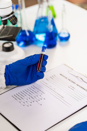Laboratory assistant picks up an experimental blood vessel. Medical researchers wear rubber gloves to protect against germs. Show the blood vessels of patients undergoing laboratorの写真素材