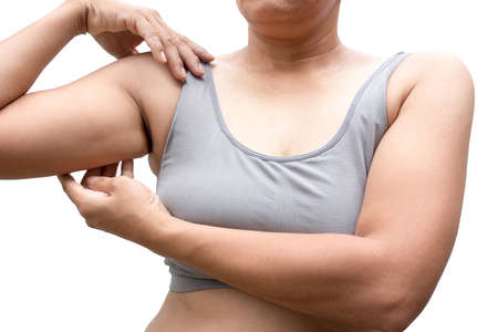 Women with arm imbalance of body fat.の写真素材