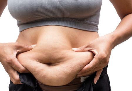 Women with fat belly and stretch marks.の写真素材