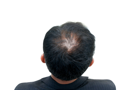 Bald head of a man on white backgroundの写真素材