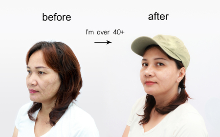 Asian middle-aged woman before and after retouch, concept of makeup or plastic surgery.の写真素材