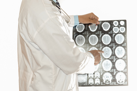 Man Doctor Looking at X-Ray Radiography in patient's Roomの写真素材
