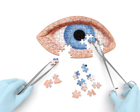 Eye operation (vision correction) puzzle concept:の写真素材