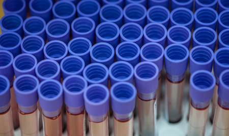Blood samples for the annual health check.の写真素材