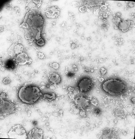 Liposomes seen under electron microscopeの写真素材