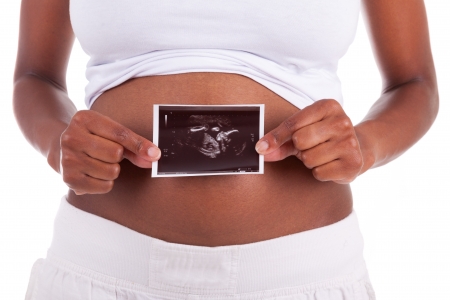 Young pregnant black woman holding an ultrasound picture in front of  her belly , isolated on white background - African peopleの写真素材
