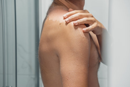 Man peeling of sun damaged peeling skin with a hand on his shoulder and back. Sunburn skin. The skin...
