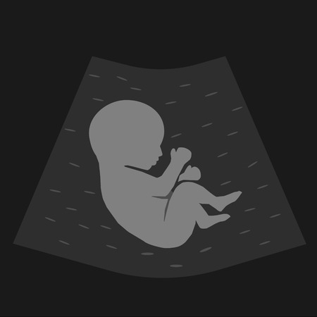 Screening baby in womb drawn in flat styleのイラスト素材