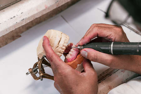 Hands of a dental technician filing a dental implantの写真素材