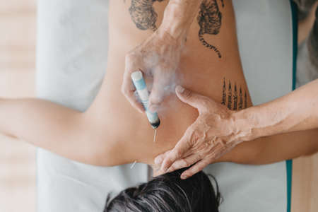 overhead shot of an acupuncturist heating the acupuncture zones with moxaの写真素材