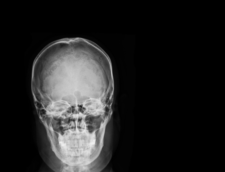 Idea from x ray image on black background.の写真素材