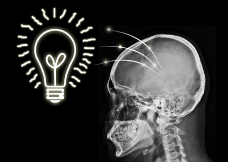Idea from x ray image on black background.