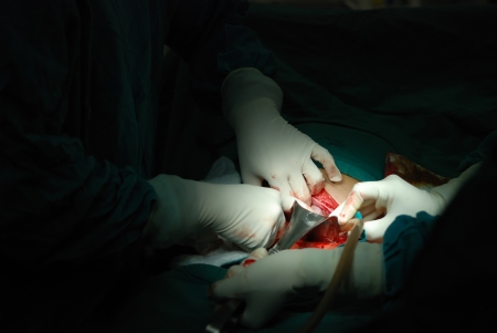 First step of abdominal surgery.のeditorial素材