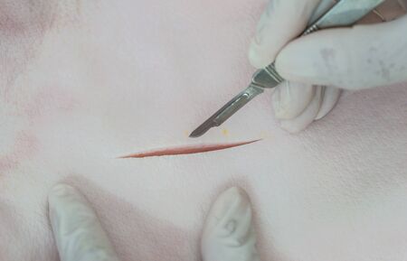 Medical procedure &quot,Skin incision&quot,.