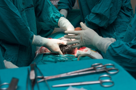 Classic cesarean section in the operating theater.のeditorial素材