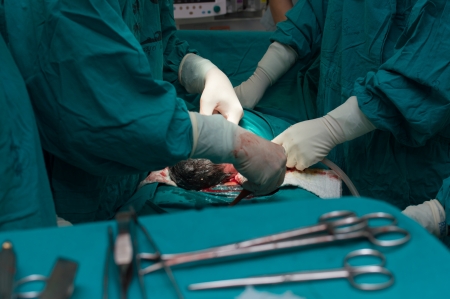 Classic cesarean section in the operating theater.のeditorial素材