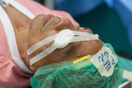 KO SAMUI, THAILAND - APRIL 5: 100 cataract patients operation royal medical project, eye pad cover after opertion on April 5, 2012 at ko samui, Thailand.のeditorial素材