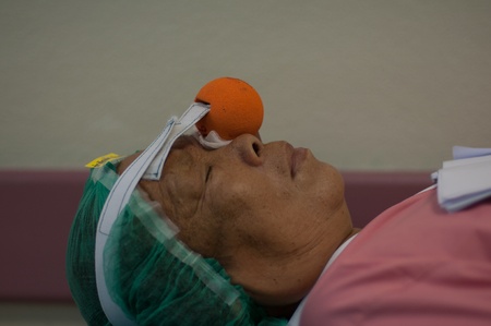KO SAMUI, THAILAND - APRIL 5: 100 cataract patients operation royal medical project, rubber ball eye compression on April 5, 2012 at ko samui, Thailand.のeditorial素材