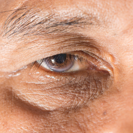 Close up of the eye during ophthalmic examination.の写真素材