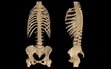 CT SCAN of Whole spine 3d rendering isolated on blurred monitor background.の写真素材