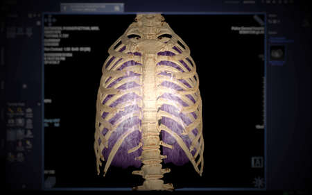 CT SCAN of Whole spine 3d rendering isolated on blurred monitor background.の写真素材