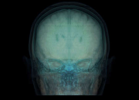 transparent image of the Skull  with  Brain for medical background concept.