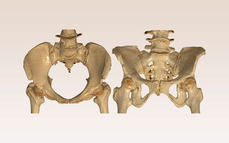 Compare of CT Scan pelvic bone with both hip joint 3D rendering image Inlet and Outlet view isolated on white background.の写真素材