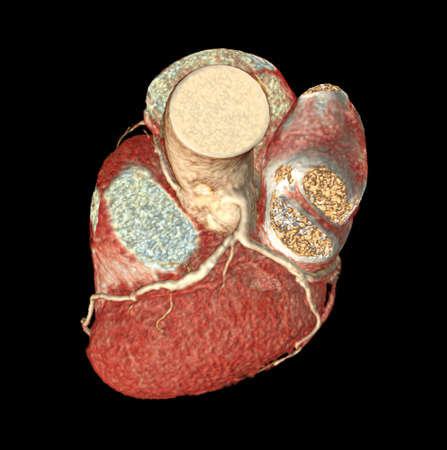 Top view of CTA virus artery 3D rendering image isolated o black backgroud for finding virus artery disease.の写真素材