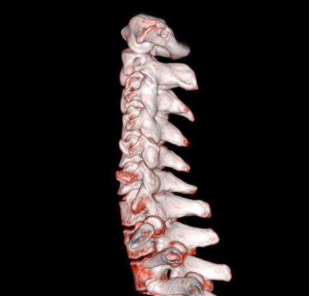 CT SCAN of Cervical Spine ( C-spine ) patient trauma case 3D rendering image .の写真素材