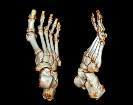 Computed Tomography of the Foot ,3D Volume Rendering examination of the Foot ( CT VR Foot) . 3D rendering.の写真素材