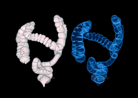 CT colonography or CT colonography  3D rendering image for diagnosis Colon cancer and colorectal...