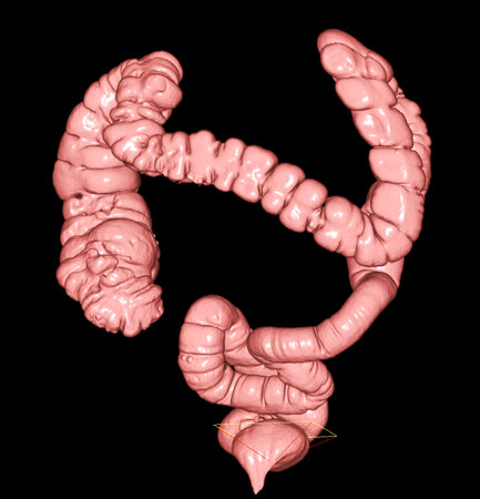CT colonography or CT colonography  3D rendering image for diagnosis Colon cancer and colorectal cancer .の写真素材