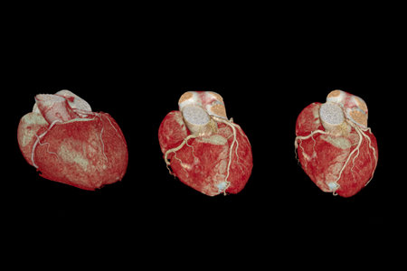 CT Cardiac 3D or CTA coronary artery for prevention coronary artery diseases isolated on black background.Clipping path.の写真素材