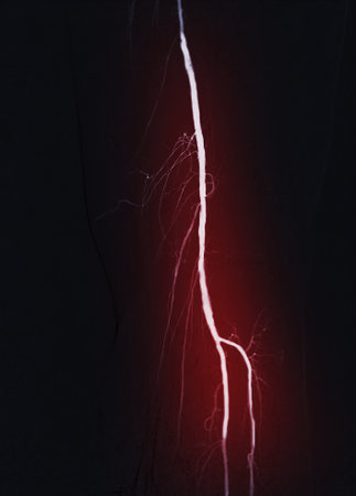 Femoral artery angiogram or angiographyの写真素材