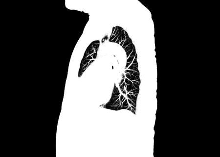 CT scan of Chest or lung sagittal view at radiology department in hospital. Covid-19 scan body xray test detection for covid virus epidemic spread conceptの写真素材