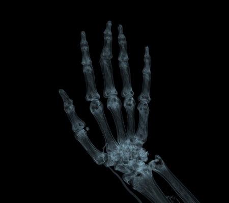 Hand 3D rendering for rheumatoid arthritis Concept.の写真素材