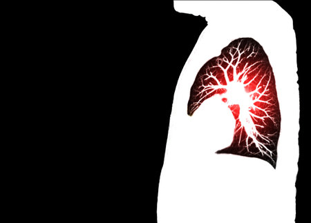 CT scan of Chest or lung sagittal view at radiology department in hospital. Covid-19 scan body xray test detection for covid virus epidemic spread conceptの写真素材