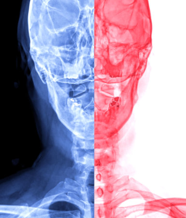 X-ray C-spine or x-ray image of Cervical spine open mount  view for  fracture of cervical vertebra...