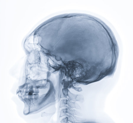 x-ray image of Human Skull   lateral view for diagnosis skull fracture  isolated on Black Background.の写真素材