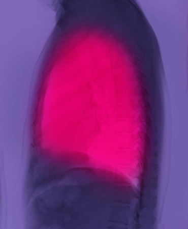 Chest X-ray or X-Ray Image of Human Lung Lateral View with full inspiration for detect heart disease...