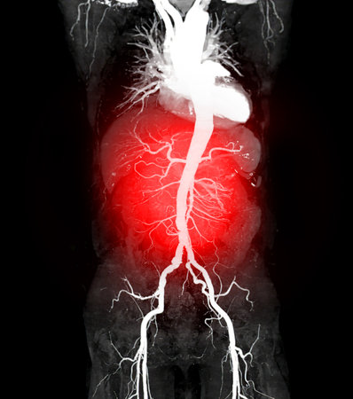 CTA whole aorta 3D rendering.の写真素材