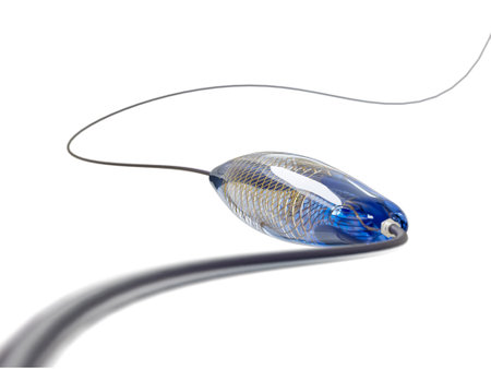 mesh metal nitinol self-expandable stent 3D rendering for endovascular surgery isolated on white...