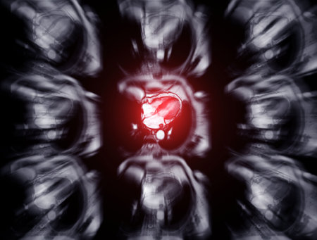 MRI heart or Cardiac MRI ( magnetic resonance imaging ) of heart for diagnosis heart disease.の写真素材