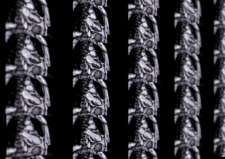 MRI heart or Cardiac MRI ( magnetic resonance imaging ) of heart for diagnosis heart disease.