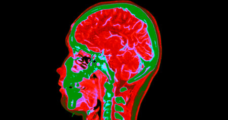 CT angiography of the brain or CTA brain and neck Sagittal view 3D Rendering image fusion color mode . medical technology concept.の写真素材
